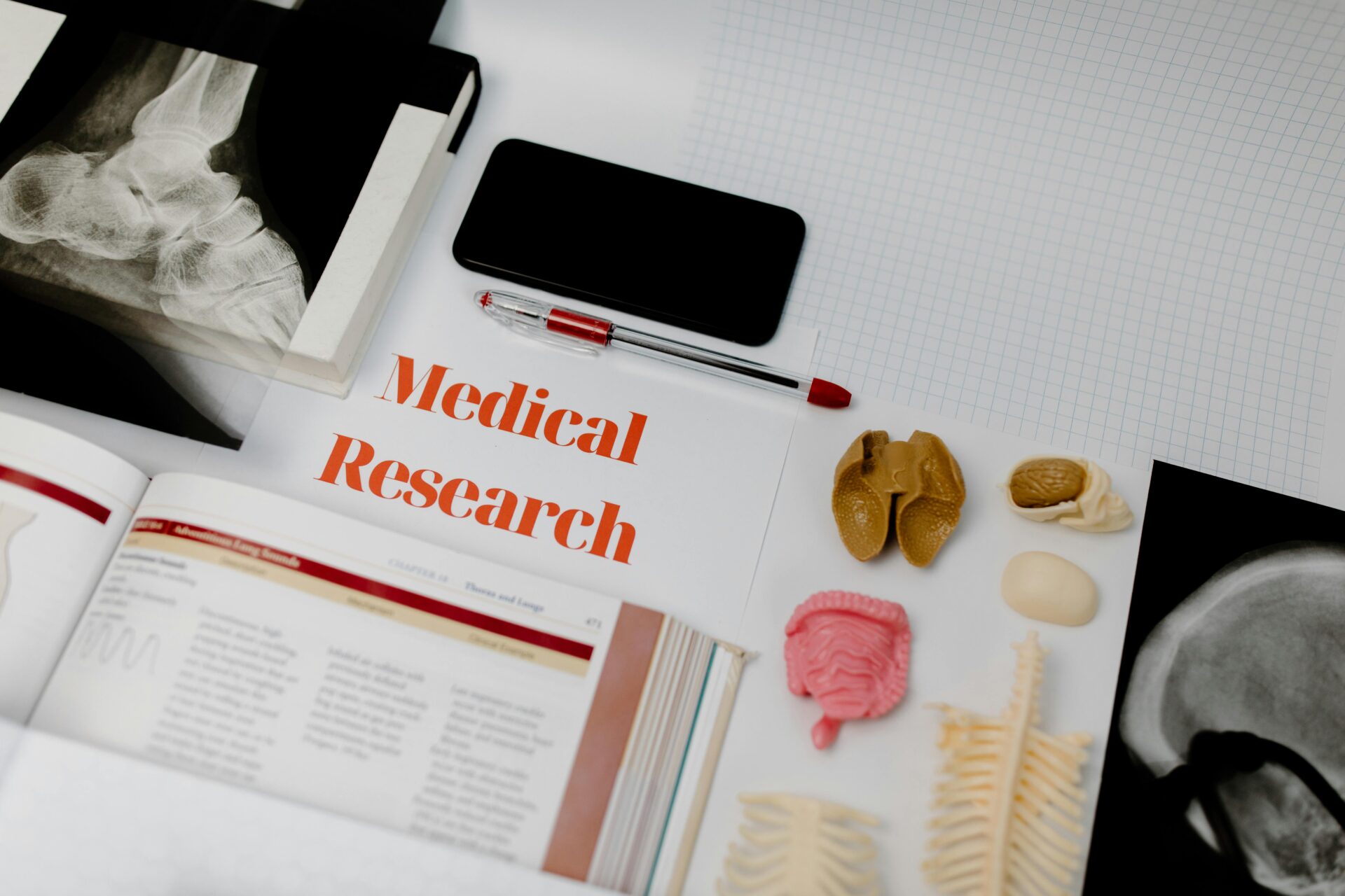 Medical research materials including a book, anatomical models, and X-rays for an article on SOAP Notes medical